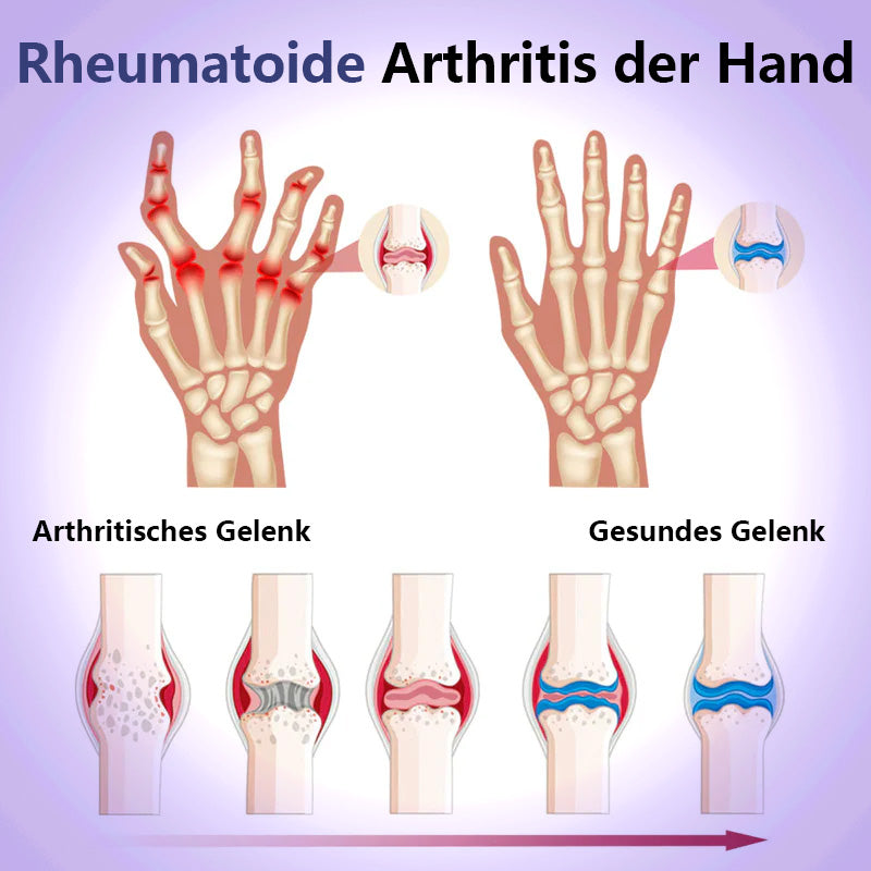 🍀Naturbelassen® Emu-Öl und Kurkuma Schmerzgel👨‍⚕️ CE genehmigt 💥